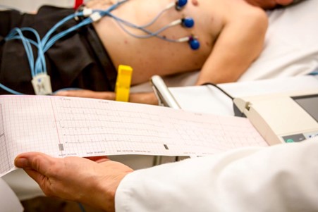 Memahami Pentingnya EKG dalam Menjaga Kesehatan Jantung